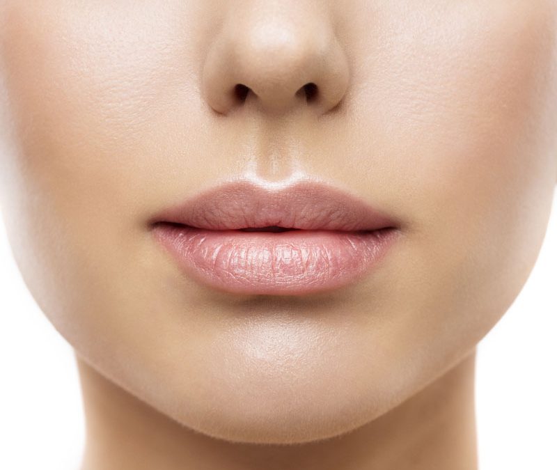 Perfilado de labios ácido hialurónico