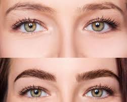 Implante de Cejas